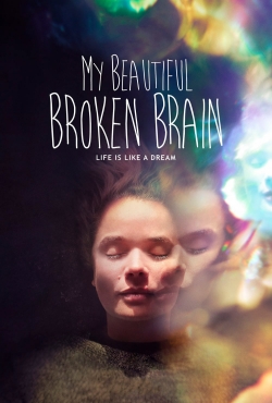 My Beautiful Broken Brain-watch
